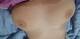 my boobs