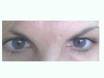 eye